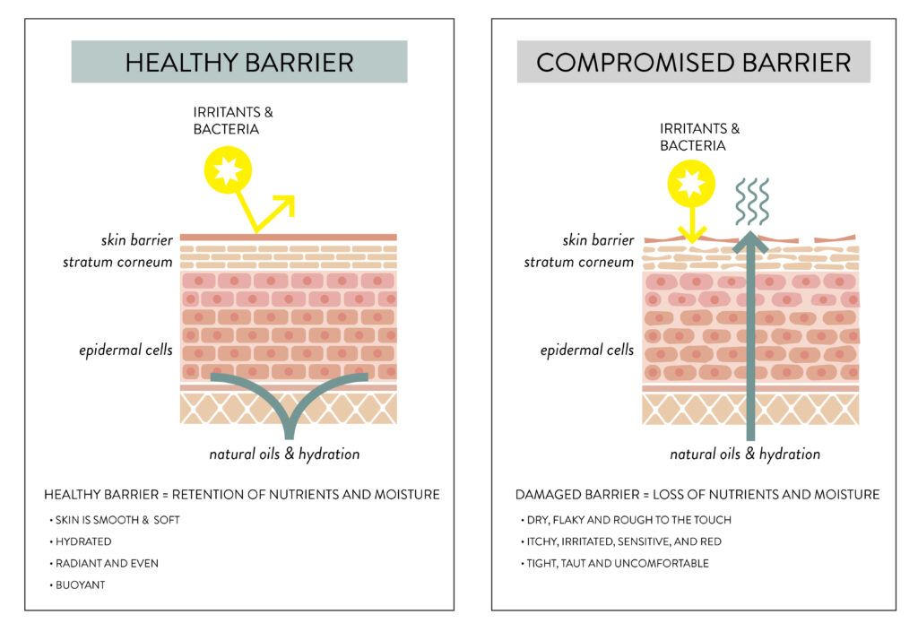 compromised skin barrier anjou spa