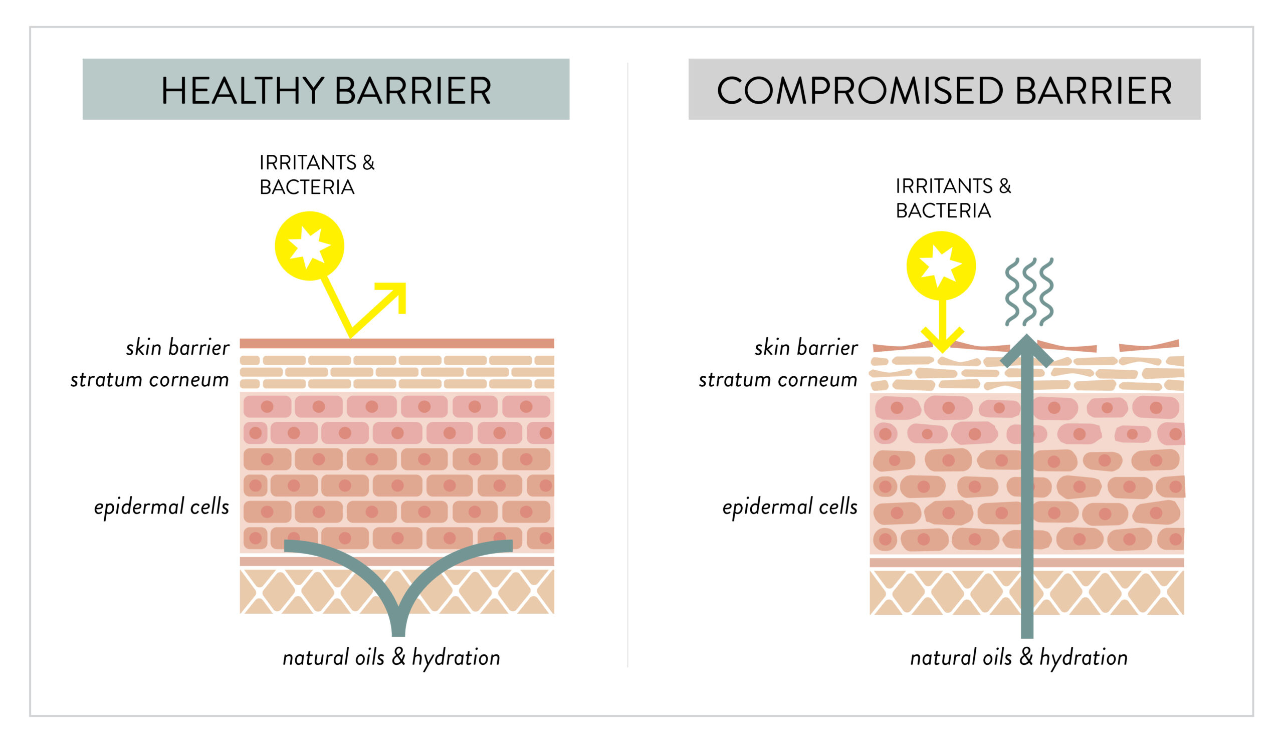 skin barrier skincare health